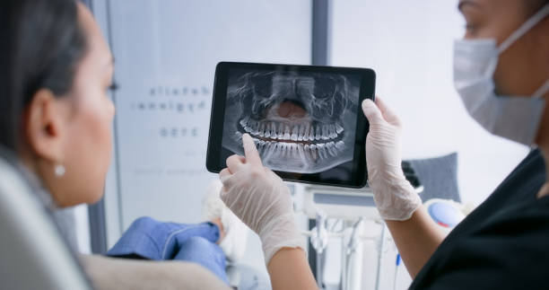 Licensed Teeth Whitening service in Milwaukie, OR - Smile Center Dentistry